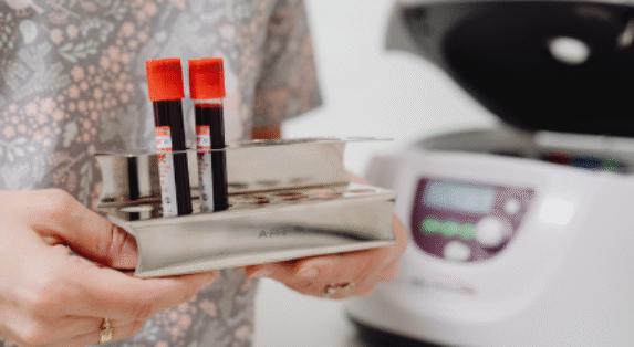 Exciting results from blood test for 50 cancers