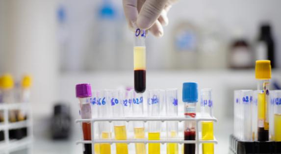 England set to be one of the first countries to eliminate hepatitis C