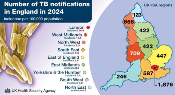 Workshop 5: Prioritising TB in local systems